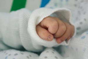婴幼儿黄疸有何症状体征婴幼儿黄疸有哪些治疗方法 