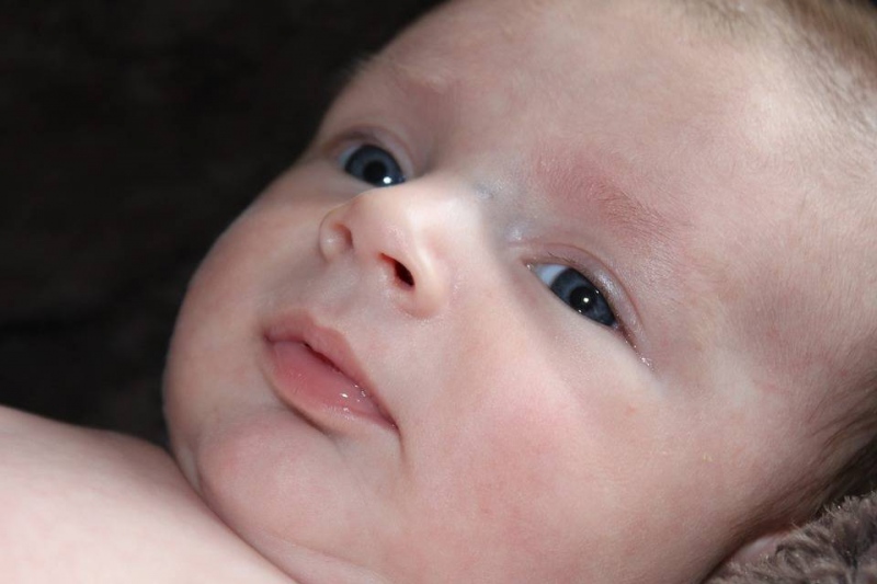 婴儿眼睛下面有皱纹的原因婴儿眼睛下面有皱纹怎么办